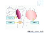 子宮がん卵巣がん.jpg.JPG